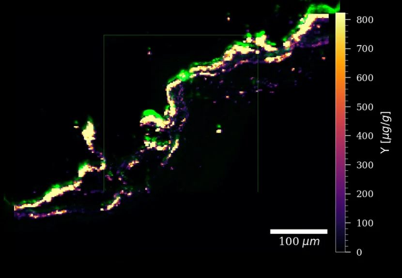 Multimodal overlay of LA-ICP-MS, NLO microscopy and ToF-SIMS signals from the same ROI in UCNP-spiked 3D tissue
