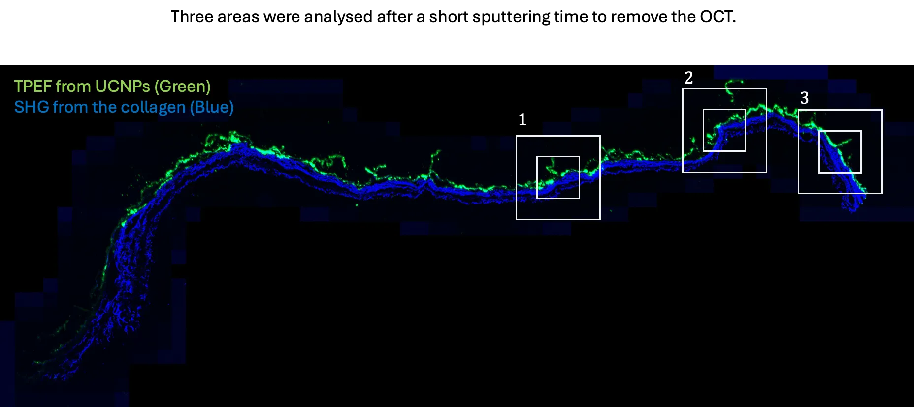 NLO TPEF-SHG mosaic of UCNP-spiked 3D tissue with regions selected for ToF-SIMS and LA-ICP-MS