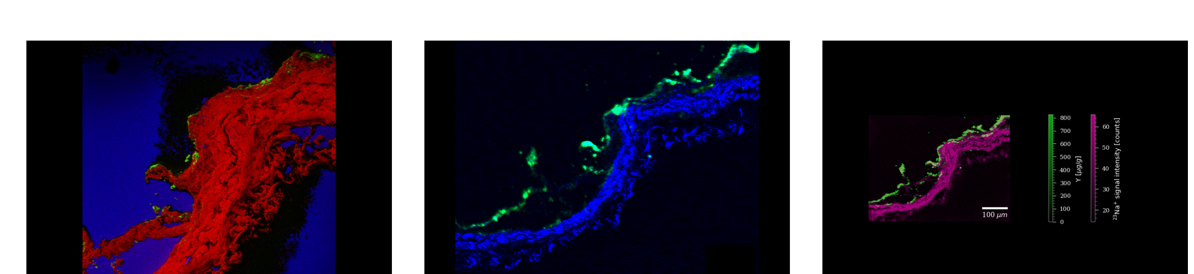 Same ROI in UCNP-spiked 3D tissue imaged by ToF-SIMS, NLO TPEF-SHG microscopy and LA-ICP-MS