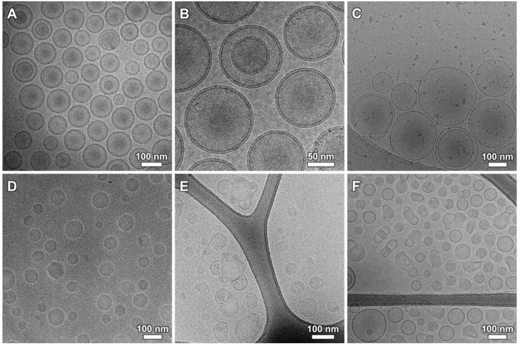Cryo TEM images showing dimensional and structural characterisation of liposomes and lipid nanoparticles